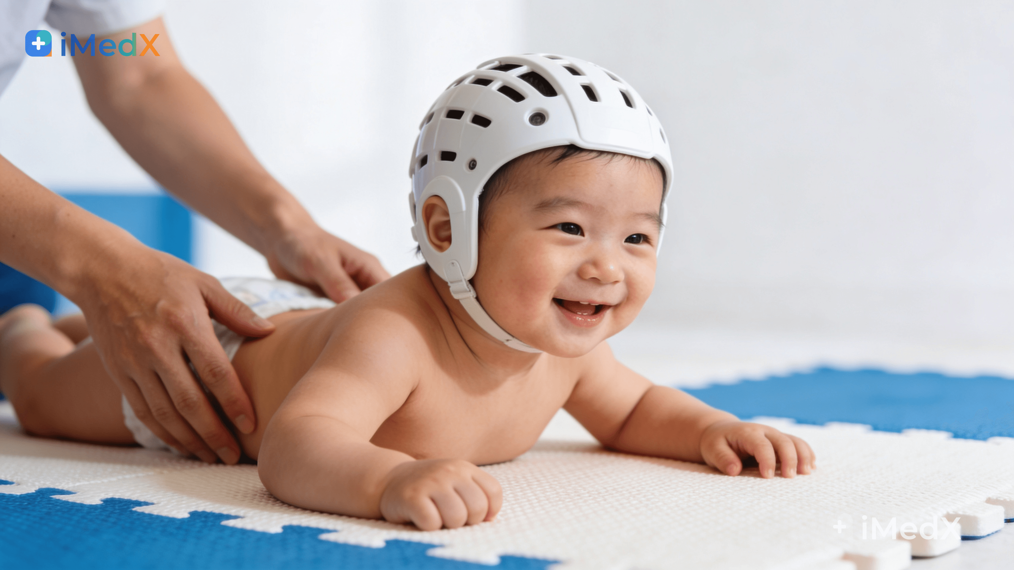 Méo đầu nên bắt đầu điều trị từ tháng thứ mấy?