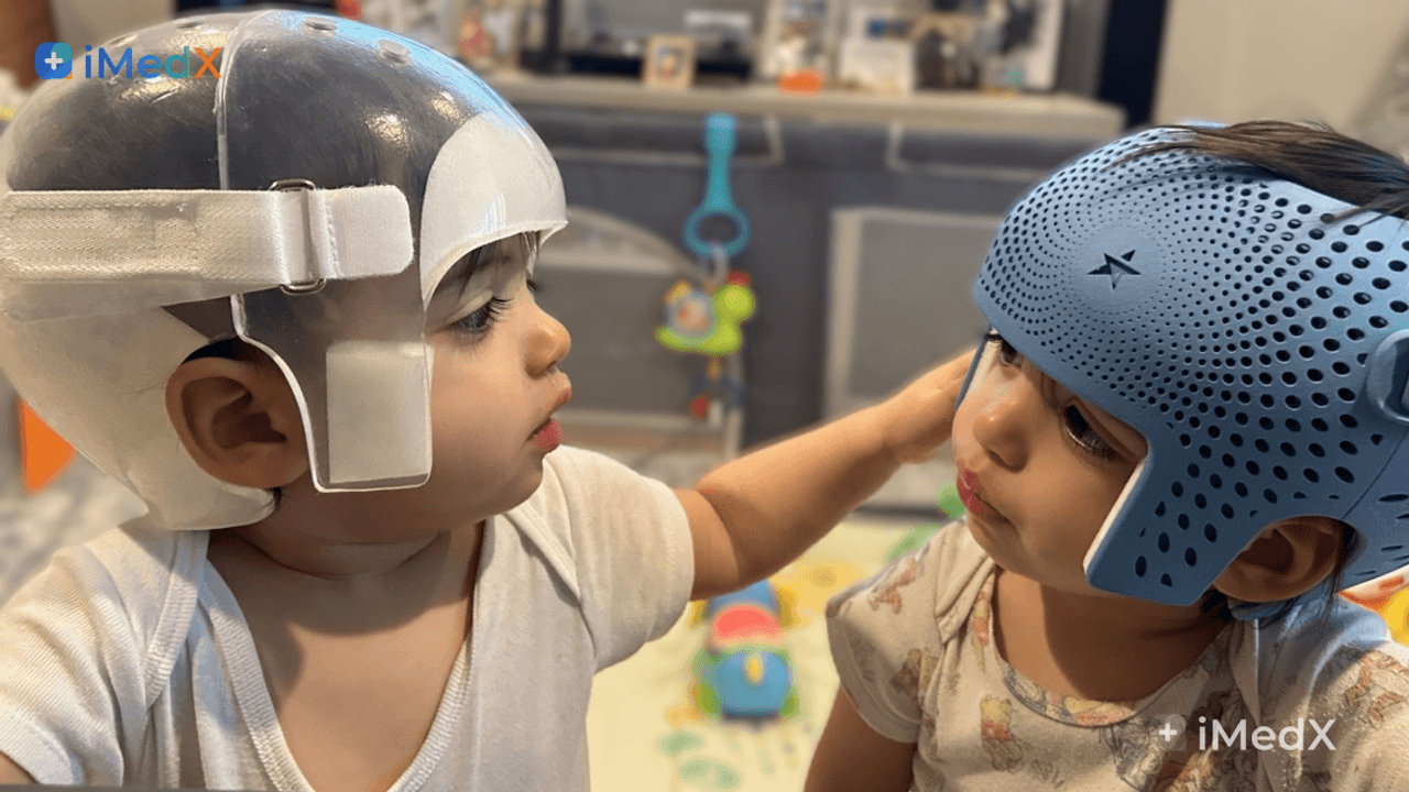 Mũ hỗ trợ định hình 3D khác gì mũ truyền thống?